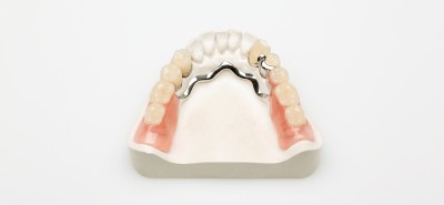 Metal frame denture