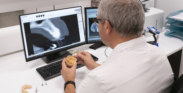 Implantology by Dental labo Vanderbeken