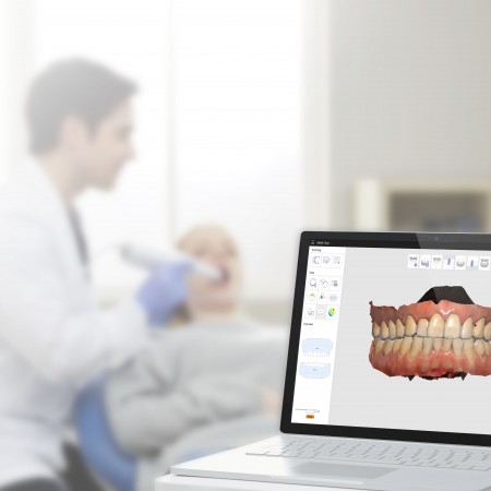 Medit i700 intra orale scan by Dental Labo Vanderbeken