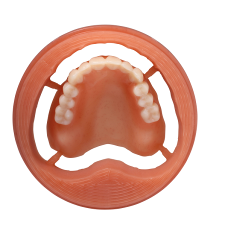 Digital denture milled by Dental Labo Vanderbeken