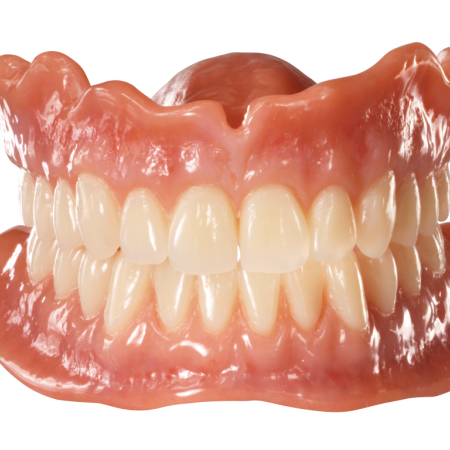 Digital denture printed by Dental Labo Vanderbeken